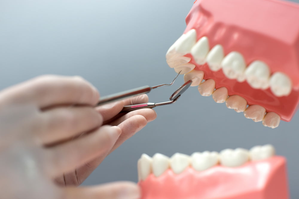 O que é a prótese protocolo e quais são os seus benefícios? 3 dentes protese